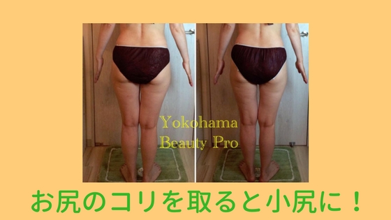 Beauty Pro ビューティープロ 筋膜リリースなら横浜 元町の認定サロン